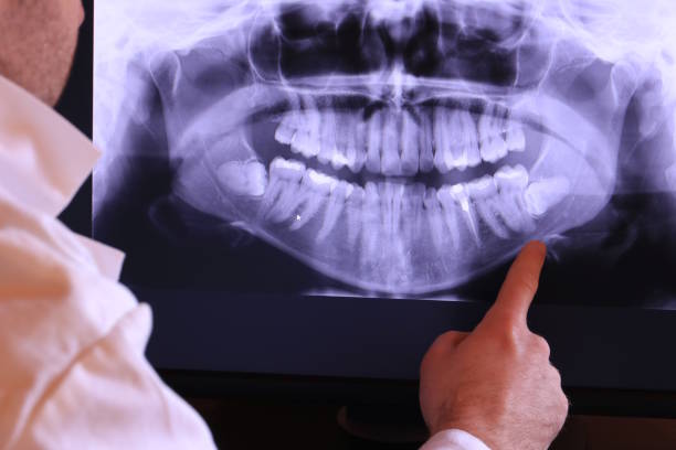Best Broken or Chipped Tooth Repair in Destin, FL