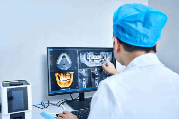 Best Emergency Wisdom Tooth Extraction in Destin, FL